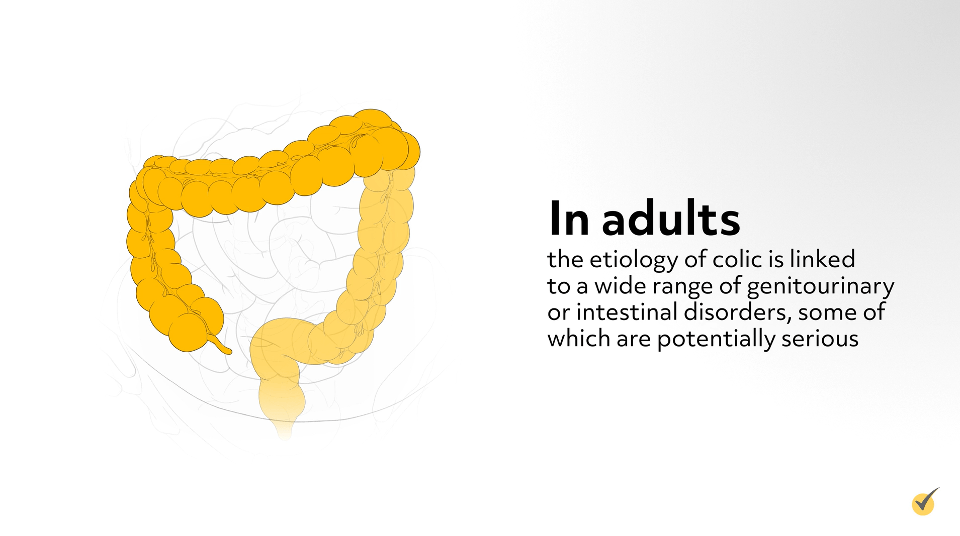 image of large intestine
