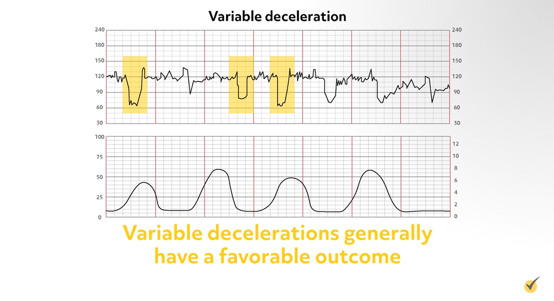 fetal-heart-rate-monitoring-examples-at-johnnie-hart-blog
