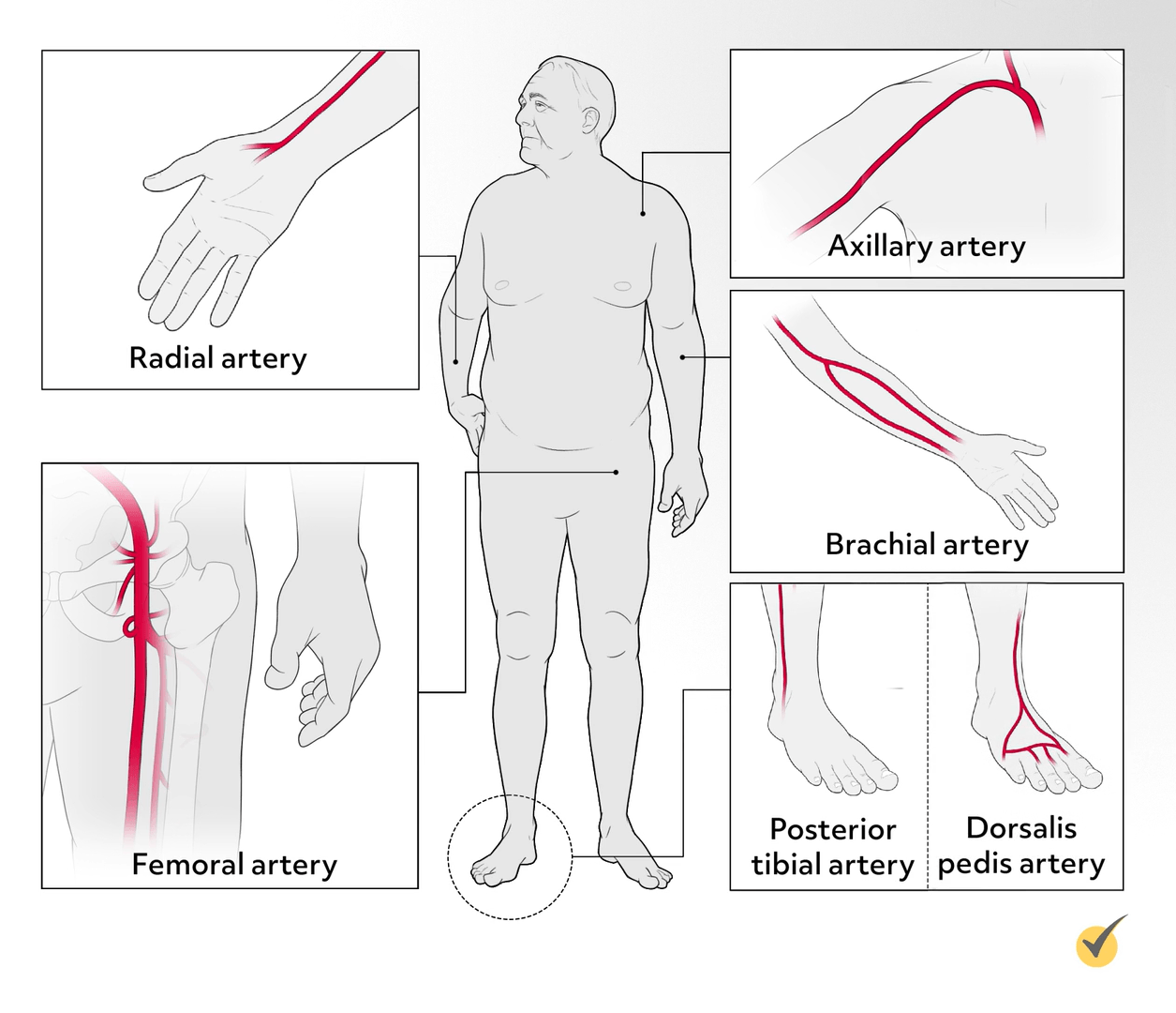 Example of where to execute an arterial puncture for a percutaneous diagnostic.
