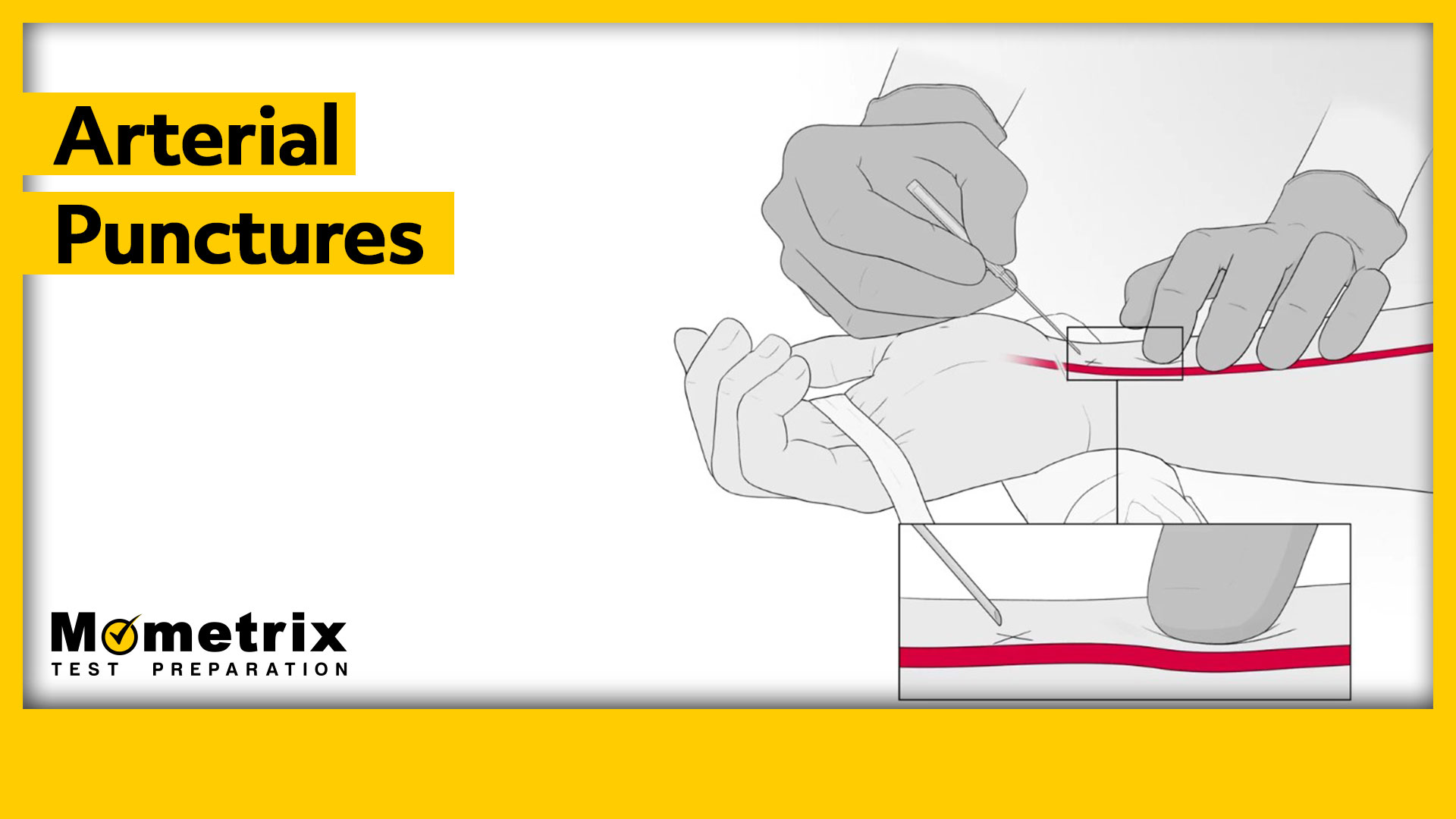 Arterial Punctures (Video)